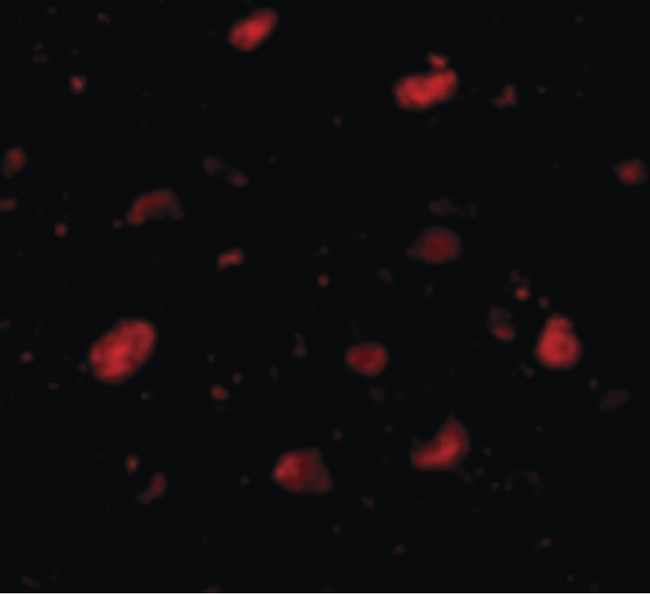 SLITRK5 Antibody - Immunofluorescence of Slitrk5 in Human Brain cells with Slitrk5 antibody at 5 ug/ml.