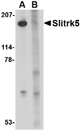 SLITRK5 Antibody - Western blot of Slitrk5 in 3T3 cell lysate with Slitrk5 antibody at 1 ug/ml in the (A) absence or (B) presence of blocking peptide.