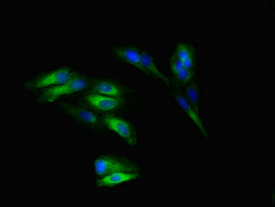 SLITRK5 Antibody - Immunofluorescent analysis of Hela cells diluted at 1:100 and Alexa Fluor 488-congugated AffiniPure Goat Anti-Rabbit IgG(H+L)
