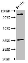 SLITRK5 Antibody - Western Blot Positive WB detected in:Mouse brain tissue All Lanes:SLITRK5 antibody at 2µg/ml Secondary Goat polyclonal to rabbit IgG at 1/50000 dilution Predicted band size: 108,80 KDa Observed band size: 108 KDa