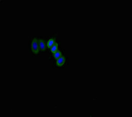 SLITRK6 Antibody - Immunofluorescent analysis of HepG2 cells using SLITRK6 Antibody at dilution of 1:100 and Alexa Fluor 488-congugated AffiniPure Goat Anti-Rabbit IgG(H+L)