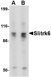 SLITRK6 Antibody - Western blot of Slitrk6 in SK-N-SH cell lysate with Slitrk6 antibody at (A) 0.5 and (B) 1 ug/ml.