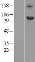 SLITRK6 Protein - Western validation with an anti-DDK antibody * L: Control HEK293 lysate R: Over-expression lysate