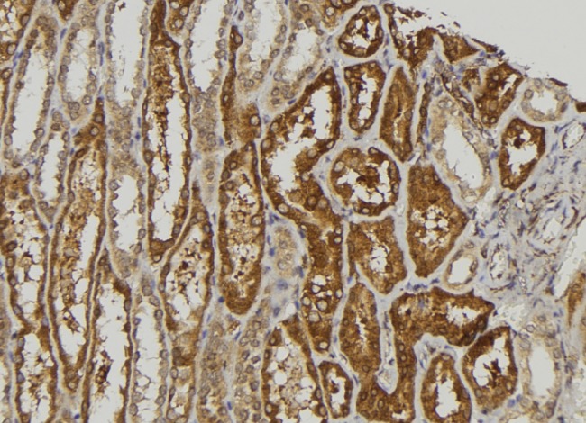 SLK Antibody - 1:100 staining human kidney tissue by IHC-P. The sample was formaldehyde fixed and a heat mediated antigen retrieval step in citrate buffer was performed. The sample was then blocked and incubated with the antibody for 1.5 hours at 22°C. An HRP conjugated goat anti-rabbit antibody was used as the secondary.