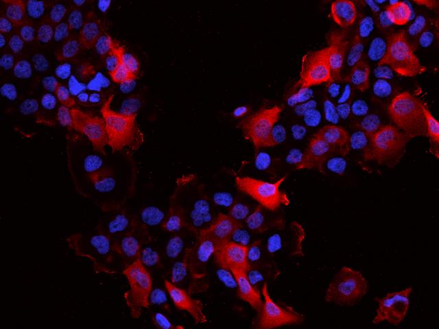 SLK Antibody - Immunofluorescence staining of SLK in A431 cells. Cells were fixed with 4% PFA, permeabilzed with 0.1% Triton X-100 in PBS, blocked with 10% serum, and incubated with rabbit anti-Human SLK polyclonal antibody (dilution ratio 1:200) at 4°C overnight. Then cells were stained with the Alexa Fluor 594-conjugated Goat Anti-rabbit IgG secondary antibody (red) and counterstained with DAPI (blue). Positive staining was localized to Cytoplasm and cell membrane.