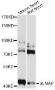 SLMAP / SLAP Antibody - Western blot analysis of extracts of various cell lines, using SLMAP antibody at 1:3000 dilution. The secondary antibody used was an HRP Goat Anti-Rabbit IgG (H+L) at 1:10000 dilution. Lysates were loaded 25ug per lane and 3% nonfat dry milk in TBST was used for blocking. An ECL Kit was used for detection and the exposure time was 30s.