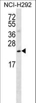 SLMO2 Antibody - SLMO2 Antibody western blot of NCI-H292 cell line lysates (35 ug/lane). The SLMO2 antibody detected the SLMO2 protein (arrow).