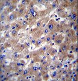 SLMO2 Antibody - SLMO2 Antibody immunohistochemistry of formalin-fixed and paraffin-embedded human liver tissue followed by peroxidase-conjugated secondary antibody and DAB staining.