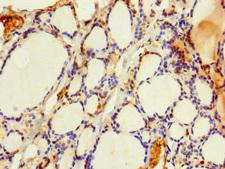 SLMO2 Antibody - Immunohistochemistry of paraffin-embedded human thyroid tissue using PRELID3B Antibody at dilution of 1:100