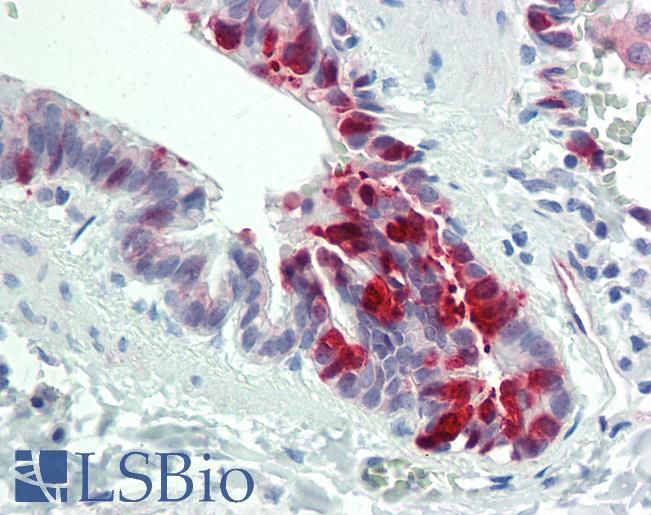 SLPI / Antileukoproteinase Antibody - Anti-ALK1 / SLPI antibody IHC staining of human lung, respiratory epithelium. Immunohistochemistry of formalin-fixed, paraffin-embedded tissue after heat-induced antigen retrieval. Antibody concentration 10 ug/ml.  This image was taken for the unconjugated form of this product. Other forms have not been tested.