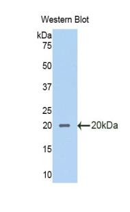 SLPI / Antileukoproteinase Antibody - Western blot of recombinant ALK1 / SLPI.  This image was taken for the unconjugated form of this product. Other forms have not been tested.