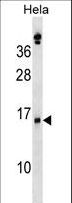 SLPI / Antileukoproteinase Antibody - SLPI Antibody western blot of HeLa cell line lysates (35 ug/lane). The SLPI antibody detected the SLPI protein (arrow).