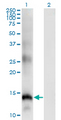 SLPI / Antileukoproteinase Antibody - Western Blot analysis of SLPI expression in transfected 293T cell line by SLPI monoclonal antibody (M01), clone 3C6.Lane 1: SLPI transfected lysate (Predicted MW: 14.52 KDa).Lane 2: Non-transfected lysate.