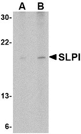 SLPI / Antileukoproteinase Antibody - Western blot of whole cell lysate from Daudi, Burkitt's lymphoma derived cels probed with Rabbit anti-Human SLP1 probed with Rabbit anti-Human SLP1 at 1(A) and 2(B) ug/ml