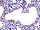 SLPI / Antileukoproteinase Antibody - Immunohistochemistry of formalin-fixed, paraffin-embedded mouse lung stained with Rabbit anti-Human SLP1 following heat mediated antigen retrieval using sodium citrate buffer (pH6.0)