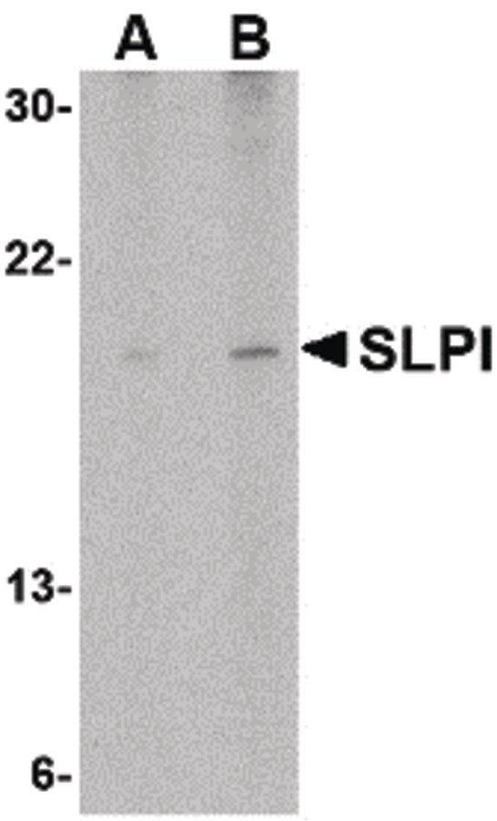 SLPI / Antileukoproteinase Antibody - Western blot of SLPI in Daudi cell lysate with SLPI antibody at (A) 1 and (B) 2 ug/ml.
