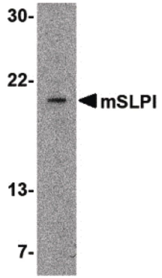 SLPI / Antileukoproteinase Antibody - Western blot of SLPI in A-20 cell lysate with SLPI antibody at 2 ug/ml.
