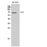 SLU7 / 9G8 Antibody - Western blot of SLU7 antibody