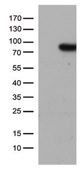 SLU7 / 9G8 Antibody - HEK293T cells were transfected with the pCMV6-ENTRY control. (Left lane) or pCMV6-ENTRY SLU7. (Right lane) cDNA for 48 hrs and lysed. Equivalent amounts of cell lysates. (5 ug per lane) were separated by SDS-PAGE and immunoblotted with anti-SLU7. (1:500)