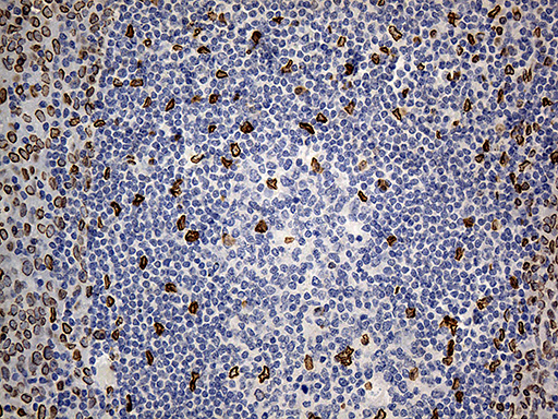 SLU7 / 9G8 Antibody - Immunohistochemical staining of paraffin-embedded Human tonsil within the normal limits using anti-SLU7 mouse monoclonal antibody. (Heat-induced epitope retrieval by 1mM EDTA in 10mM Tris buffer. (pH8.5) at 120°C for 3 min. (1:1000)