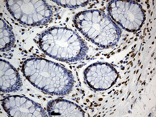 SLU7 / 9G8 Antibody - Immunohistochemical staining of paraffin-embedded Human colon tissue within the normal limits using anti-SLU7 mouse monoclonal antibody. (Heat-induced epitope retrieval by 1mM EDTA in 10mM Tris buffer. (pH8.5) at 120°C for 3 min. (1:1000)