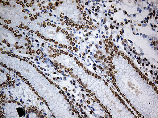 SLU7 / 9G8 Antibody - Immunohistochemical staining of paraffin-embedded Human gastric tissue within the normal limits using anti-SLU7 mouse monoclonal antibody. (Heat-induced epitope retrieval by 1mM EDTA in 10mM Tris buffer. (pH8.5) at 120°C for 3 min. (1:1000)
