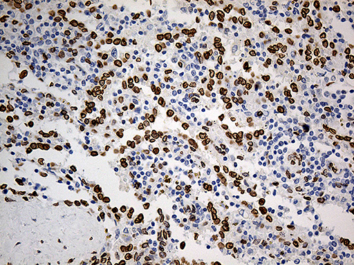 SLU7 / 9G8 Antibody - Immunohistochemical staining of paraffin-embedded Human spleen tissue within the normal limits using anti-SLU7 mouse monoclonal antibody. (Heat-induced epitope retrieval by 1mM EDTA in 10mM Tris buffer. (pH8.5) at 120°C for 3 min. (1:1000)