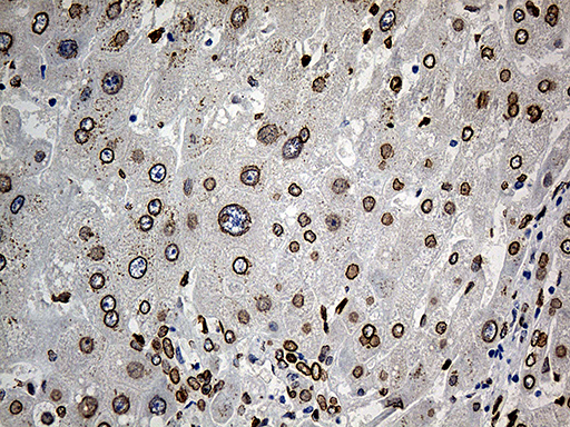 SLU7 / 9G8 Antibody - Immunohistochemical staining of paraffin-embedded Human liver tissue within the normal limits using anti-SLU7 mouse monoclonal antibody. (Heat-induced epitope retrieval by 1mM EDTA in 10mM Tris buffer. (pH8.5) at 120°C for 3 min. (1:1000)