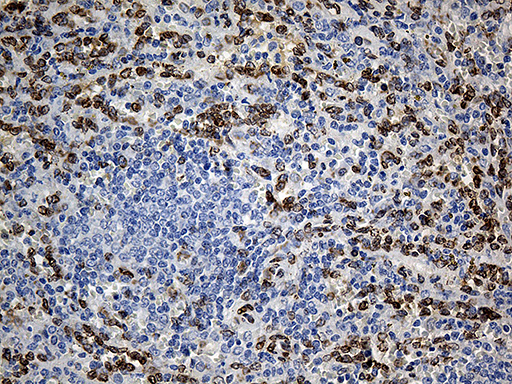 SLU7 / 9G8 Antibody - Immunohistochemical staining of paraffin-embedded Human lymph node tissue within the normal limits using anti-SLU7 mouse monoclonal antibody. (Heat-induced epitope retrieval by 1mM EDTA in 10mM Tris buffer. (pH8.5) at 120°C for 3 min. (1:500)