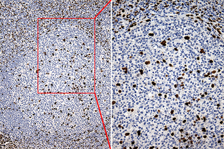 SLU7 / 9G8 Antibody - Immunohistochemical staining of paraffin-embedded Human tonsil within the normal limits using anti-SLU7 mouse monoclonal antibody. (Heat-induced epitope retrieval by 1mM EDTA in 10mM Tris buffer. (pH8.5) at 120°C for 3 min. (1:500)