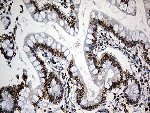 SLU7 / 9G8 Antibody - Immunohistochemical staining of paraffin-embedded Human colon tissue within the normal limits using anti-SLU7 mouse monoclonal antibody. (Heat-induced epitope retrieval by 1mM EDTA in 10mM Tris buffer. (pH8.5) at 120°C for 3 min. (1:500)
