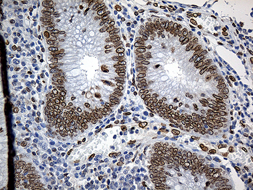 SLU7 / 9G8 Antibody - Immunohistochemical staining of paraffin-embedded Human appendix tissue within the normal limits using anti-SLU7 mouse monoclonal antibody. (Heat-induced epitope retrieval by 1mM EDTA in 10mM Tris buffer. (pH8.5) at 120°C for 3 min. (1:500)