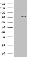 SLU7 / 9G8 Antibody - HEK293T cells were transfected with the pCMV6-ENTRY control. (Left lane) or pCMV6-ENTRY SLU7. (Right lane) cDNA for 48 hrs and lysed