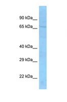 SLU7 / 9G8 Antibody - SLU7 antibody Western blot of Mouse Kidney lysate. Antibody concentration 1 ug/ml.  This image was taken for the unconjugated form of this product. Other forms have not been tested.