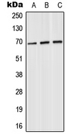 SLU7 / 9G8 Antibody - Western blot analysis of SLU7 expression in HeLa (A); SP2/0 (B); PC12 (C) whole cell lysates.