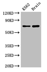SLU7 / 9G8 Antibody - Positive WB detected in:K562 whole cell lysate,Mouse brain tissue;All lanes:SLU7 antibody at 3?g/ml;Secondary;Goat polyclonal to rabbit IgG at 1/50000 dilution;Predicted band size: 69 KDa;Observed band size: 69 KDa;