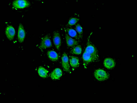 SLU7 / 9G8 Antibody - Immunofluorescent analysis of A549 cells using SLU7 Antibody at a dilution of 1:100 and Alexa Fluor 488-congugated AffiniPure Goat Anti-Rabbit IgG(H+L)