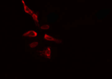 SLU7 / 9G8 Antibody - Staining HeLa cells by IF/ICC. The samples were fixed with PFA and permeabilized in 0.1% Triton X-100, then blocked in 10% serum for 45 min at 25°C. The primary antibody was diluted at 1:200 and incubated with the sample for 1 hour at 37°C. An Alexa Fluor 594 conjugated goat anti-rabbit IgG (H+L) antibody, diluted at 1/600, was used as secondary antibody.