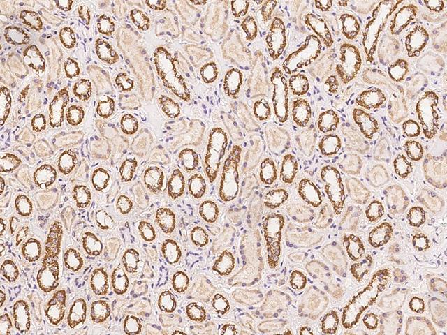 SLX1A / GIYD1 Antibody - Immunochemical staining of human SLX1A in human kidney with rabbit polyclonal antibody at 1:500 dilution, formalin-fixed paraffin embedded sections.