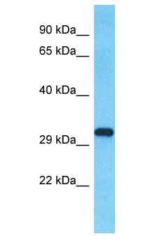 SLX1A / GIYD2 Antibody - GIYD2 antibody Western Blot of Fetal Brain. Antibody dilution: 1 ug/ml.  This image was taken for the unconjugated form of this product. Other forms have not been tested.