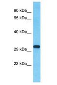 SLX1A / GIYD2 Antibody - GIYD2 antibody Western Blot of Fetal Brain. Antibody dilution: 1 ug/ml.  This image was taken for the unconjugated form of this product. Other forms have not been tested.