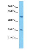 SLX1A / GIYD2 Antibody - GIYD2 antibody Western Blot of Fetal Lung. Antibody dilution: 1 ug/ml.  This image was taken for the unconjugated form of this product. Other forms have not been tested.