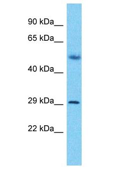 SLX1A / GIYD2 Antibody - GIYD2 antibody Western Blot of Fetal Lung. Antibody dilution: 1 ug/ml.  This image was taken for the unconjugated form of this product. Other forms have not been tested.