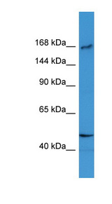 SLX4 Antibody - SLX4 antibody Western blot of ACHN lysate.  This image was taken for the unconjugated form of this product. Other forms have not been tested.