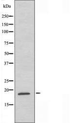 Sma3 Antibody - Western blot analysis of extracts of K562 cells using GUSBL1 antibody.