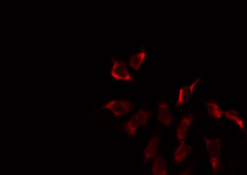 Sma3 Antibody - Staining HeLa cells by IF/ICC. The samples were fixed with PFA and permeabilized in 0.1% Triton X-100, then blocked in 10% serum for 45 min at 25°C. The primary antibody was diluted at 1:200 and incubated with the sample for 1 hour at 37°C. An Alexa Fluor 594 conjugated goat anti-rabbit IgG (H+L) Ab, diluted at 1/600, was used as the secondary antibody.