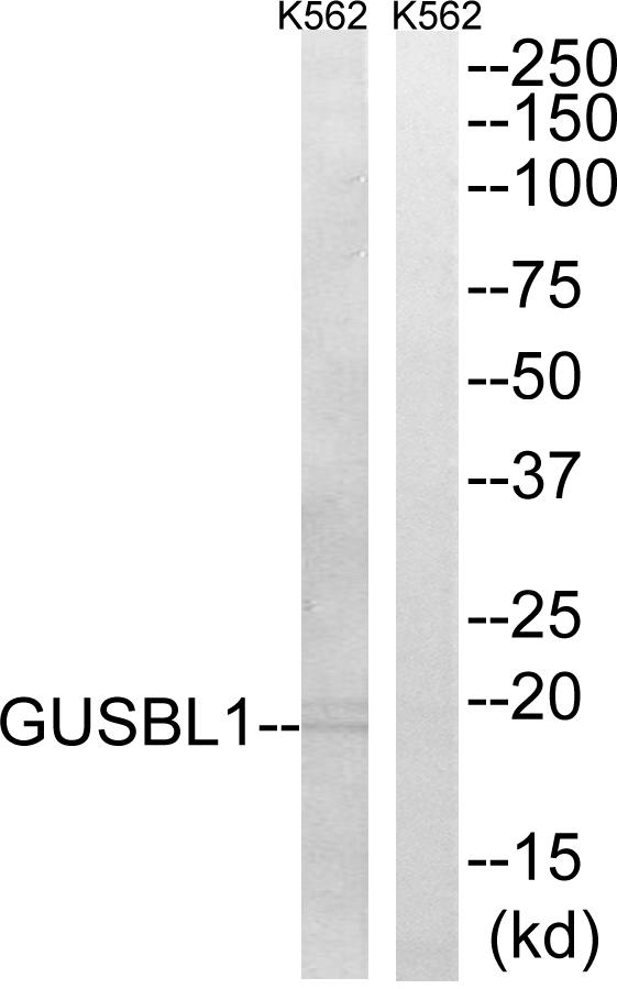 Sma3 Antibody - Western blot analysis of extracts from K562 cells, using GUSBL1 antibody.