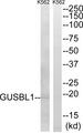 Sma3 Antibody - Western blot analysis of extracts from K562 cells, using GUSBL1 antibody.