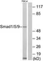 SMAD1+5+9 Antibody - Western blot analysis of lysates from HeLa cells, using Smad1/5/9 Antibody. The lane on the right is blocked with the synthesized peptide.
