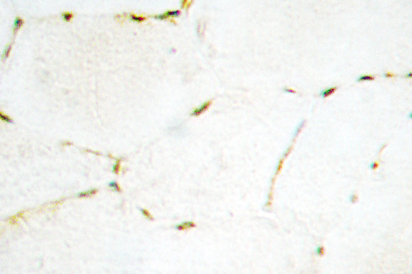 SMAD1+5+9 Antibody - IHC of Smad1/5/9 (Q22) pAb in paraffin-embedded human skeletal muscle tissue.